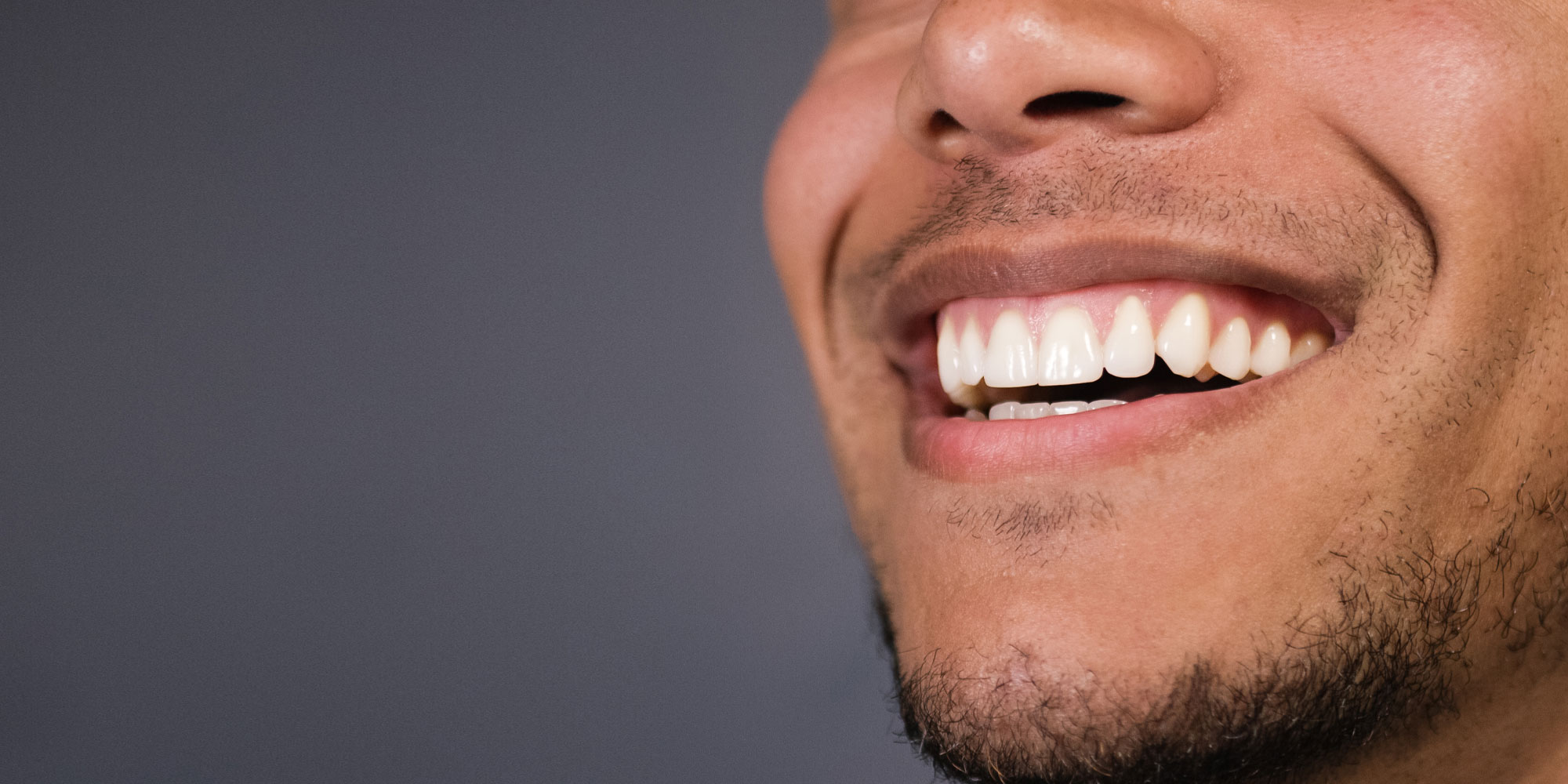 dental patient with gum recession